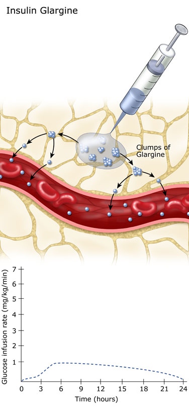 Insulin Glargine